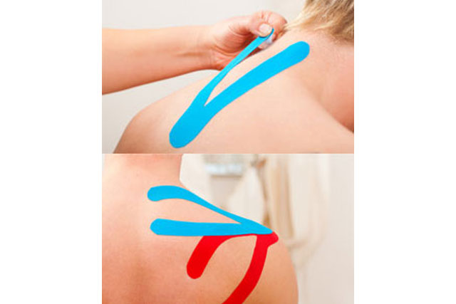 Kinesiotaping Merten